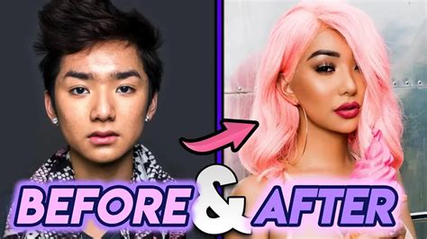 Nikita Draguns Plastic Surgery Journey — Before and。